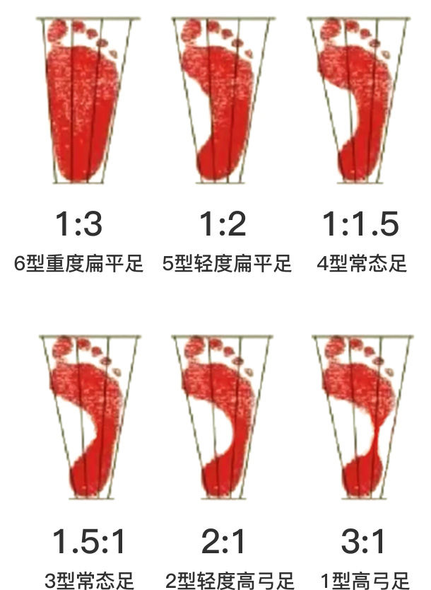 脚型